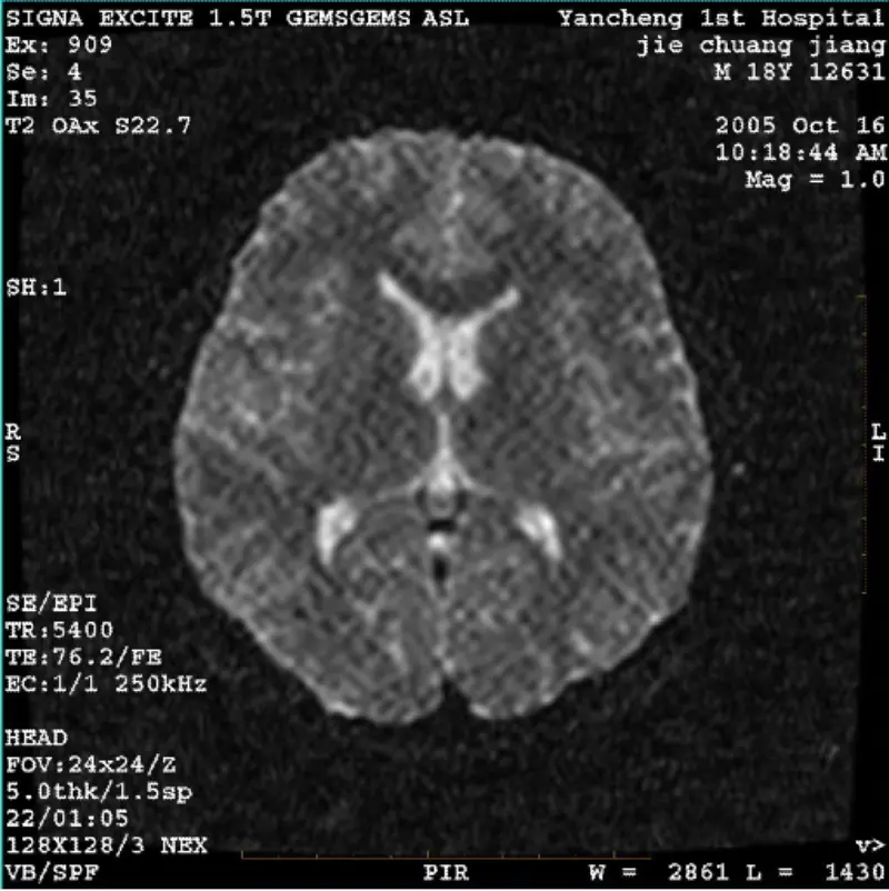 ARTIFACT WI/Fiesta Image Pixel alb